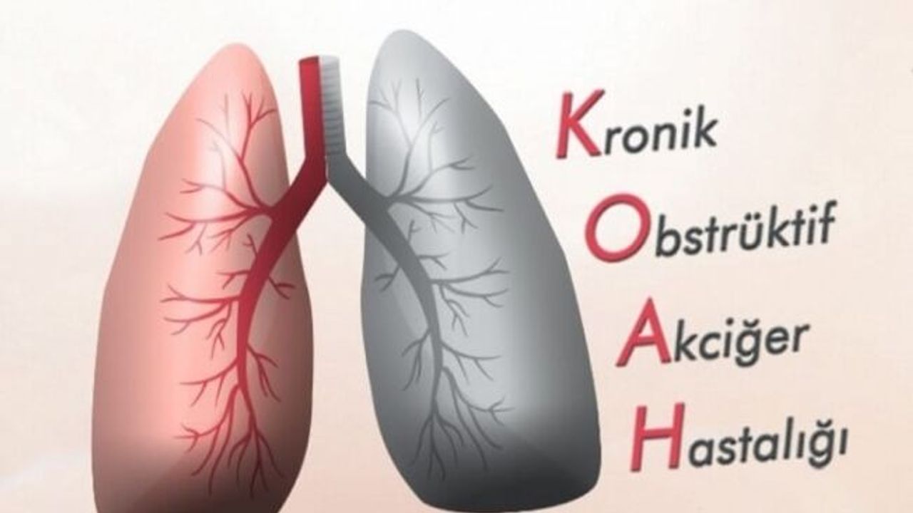 KOAH hakkında bilinmesi gereken beş önemli nokta