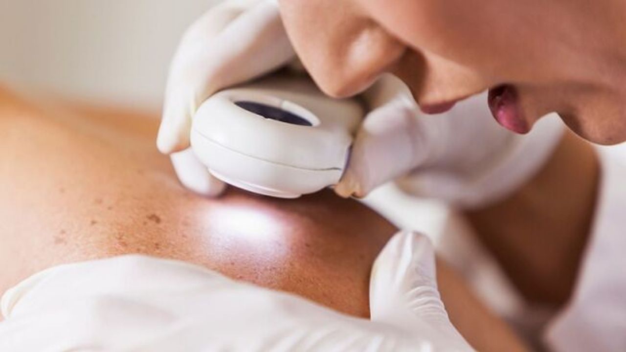 Cilt Kanserine karşı koruma rehberi