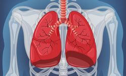 Aniden gelişen tek taraflı göğüs ağrısına dikkat!