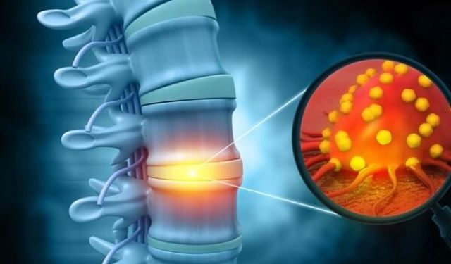 Tümöre “canlı takip”